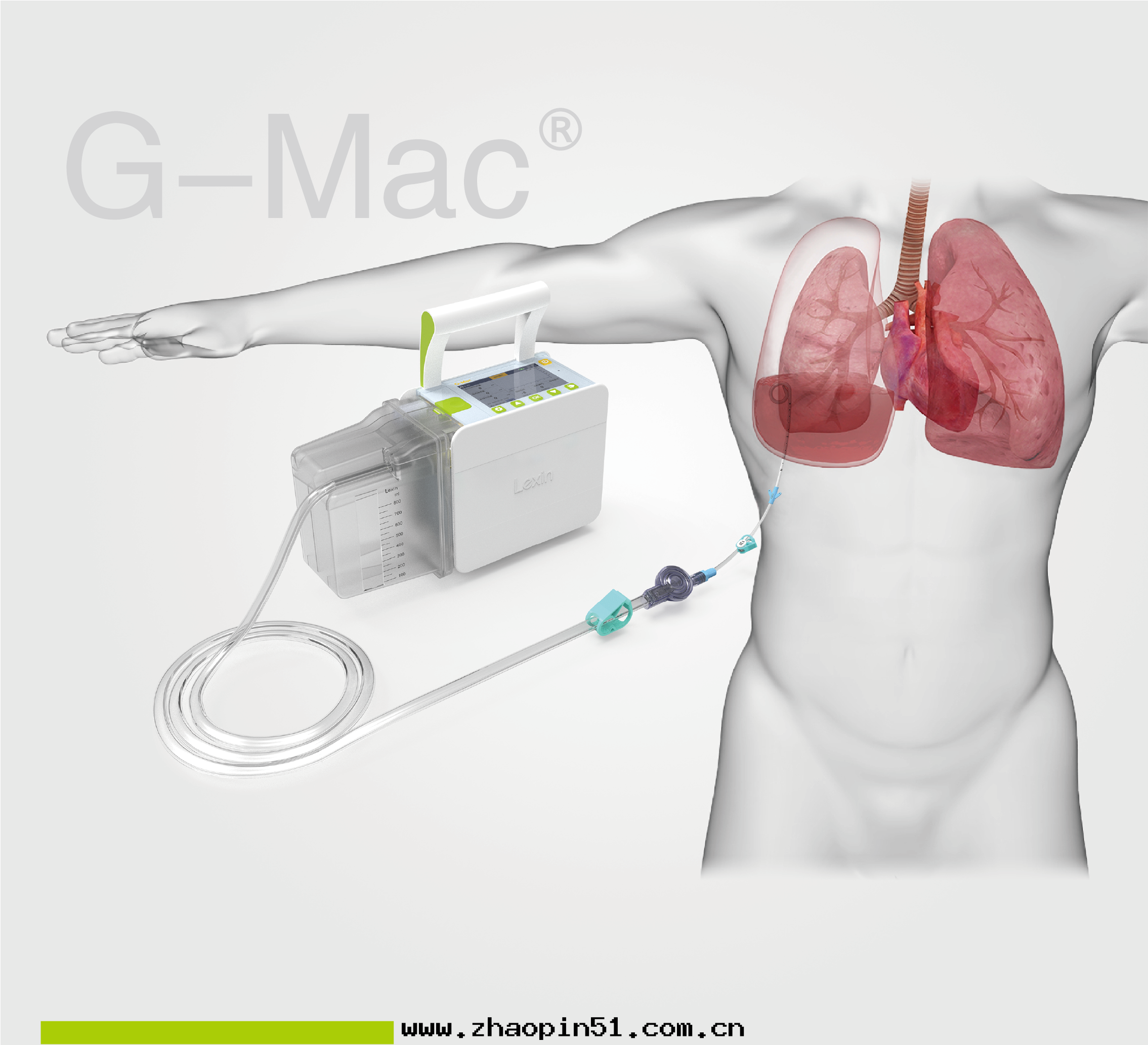 【火(huǒ)热(rè)招商】乐(lè)信(xìn)數字(zì)化(huà)醫療器械(線(xiàn)上(shàng))展(zhǎn)——第(dì)二(èr)期(qī)·胸腔引流監控系(xì)統 G-Mac®